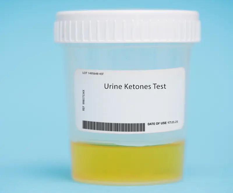 Ketones in Urine: Causes, Symptoms, and What to Do
